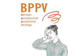 “Remember the Spinning Game? It Might Explain Your Vertigo Today”